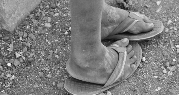 Quelque 200 enfants sont suivis par SAFIRE.